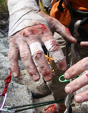 Evan’s hands after climbing “The Scoop.” Photo © Matt Clifton.